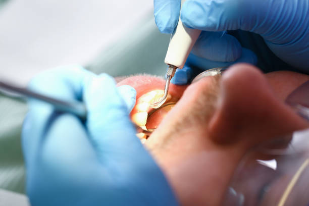 Best Pediatric Emergency Dentist in Pickerington, OH