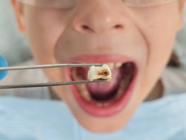 Best After-Hours Emergency Dentist in Pickerington, OH